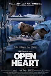 Open Heart