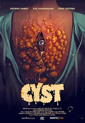 Cyst